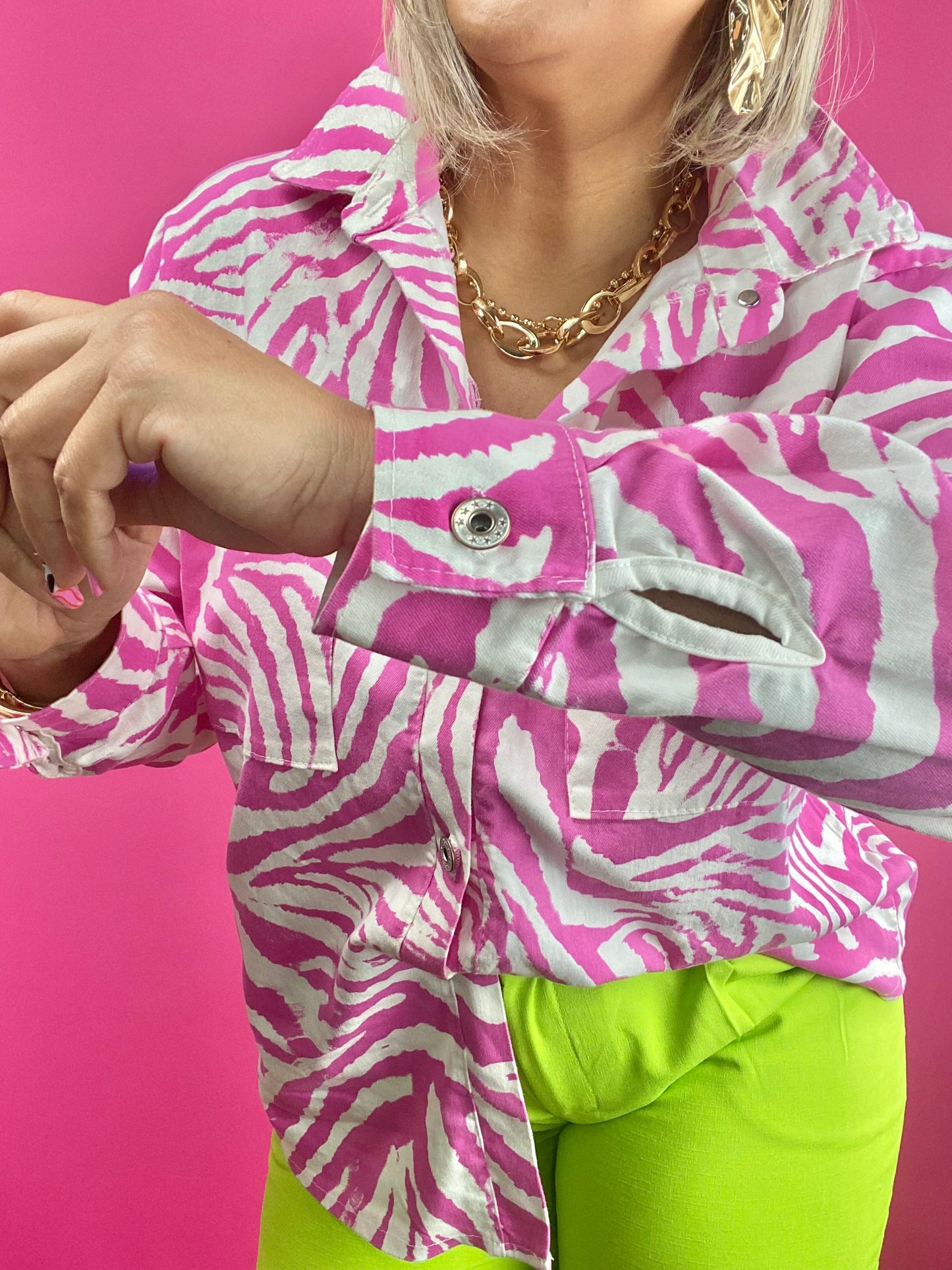 Zebra Shell Button Top